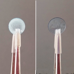 Home lentesantesdepois quadrada achatada